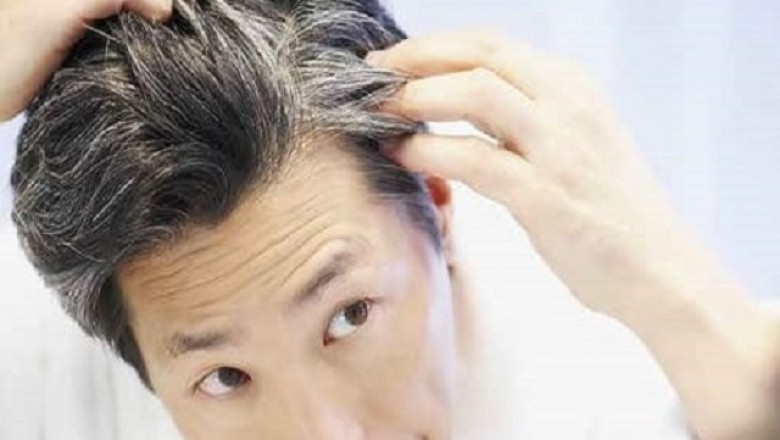 Hair Transplant Houston, Cost and Hair Loss Treatment