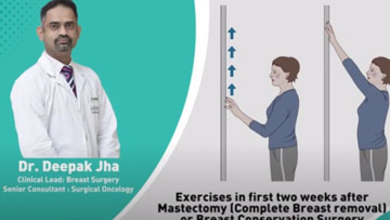 Exercises After Best Breast Surgery in Delhi Immediately After Surgery | Dr. Deepak Jha
