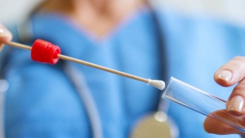 Carrier Screening Market Size, Share, Outlook, and Opportunity Analysis, 2019– 2027