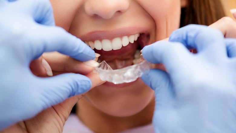Wide range of orthodontic treatments in Brooklyn