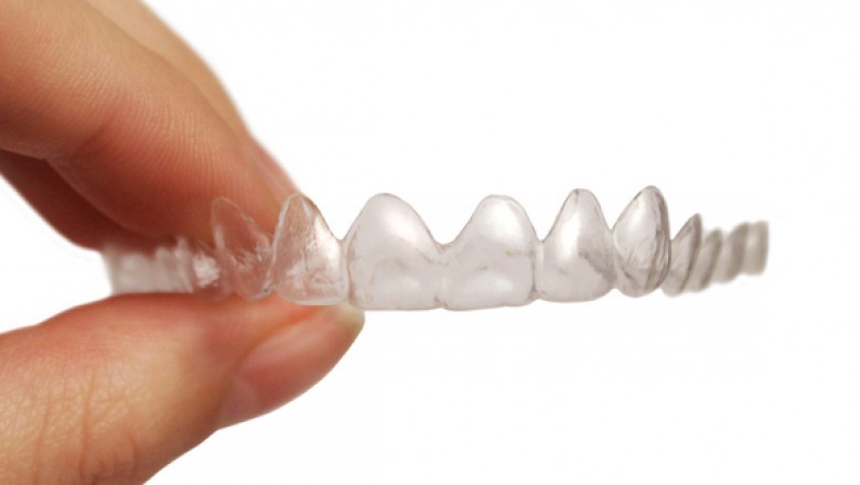 3 Unique Things to understand About Invisalign Aligners | bluewaterdentalfl