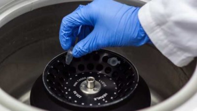 Laboratory centrifuge is a machine that use centrifugal force for separation of liquids, fluids and gas.