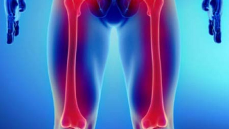 The high frequency of bone cancer, as well as the discovery and approval of novel medicines, are projected to drive the market for bone cancer treatment.