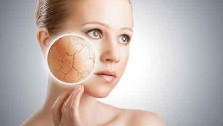 Psoriasis Treatment in Hyderabad | cleoskinclinic
