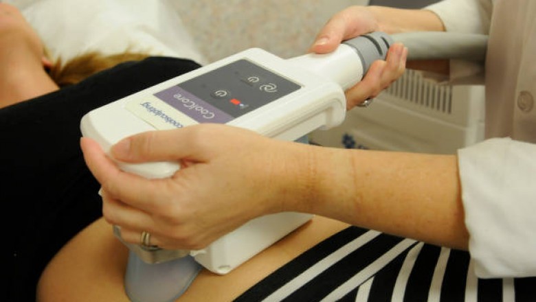 Does coolsculpting really work