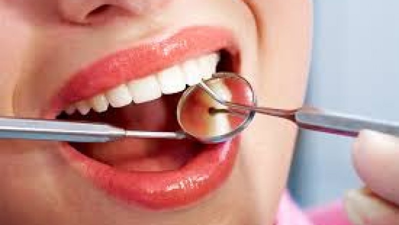 Dental restoration: What Are Different Methods?
