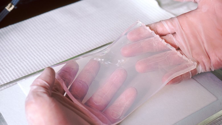 Southern blotting is a technique for detecting a specific DNA sequence in a blood or tissue sample in the laboratory.