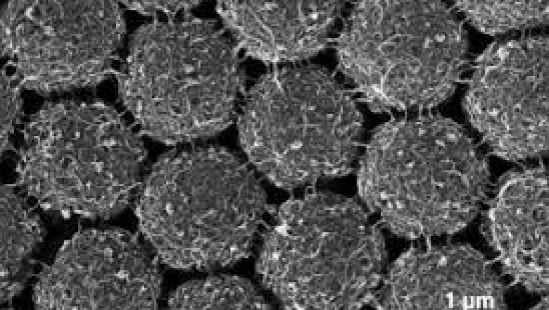 Implantable nanoengineered prosthetics are used to replace missing body organs