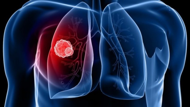 How does Cancer/Tumor Profiling work? What are the various sorts of profilers employed during the procedure?