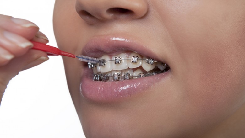 Why You Need The Best Cosmetic Dentistry In Brooklyn?
