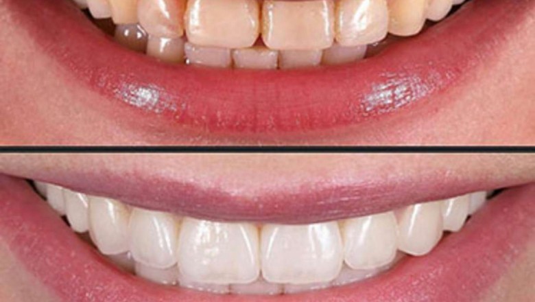 What to look for in an emergency dentist?