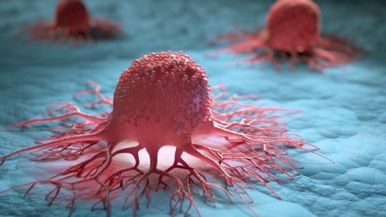 Surgery Is Often the Only Solid Tumors Treatment Used on Various Types of Cancers