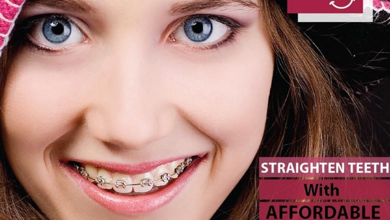 Best Dental Clinic in Banjara Hills | Best Cosmetic Dental Clinic In Banjara Hills | Best Dentist In Banjara Hills