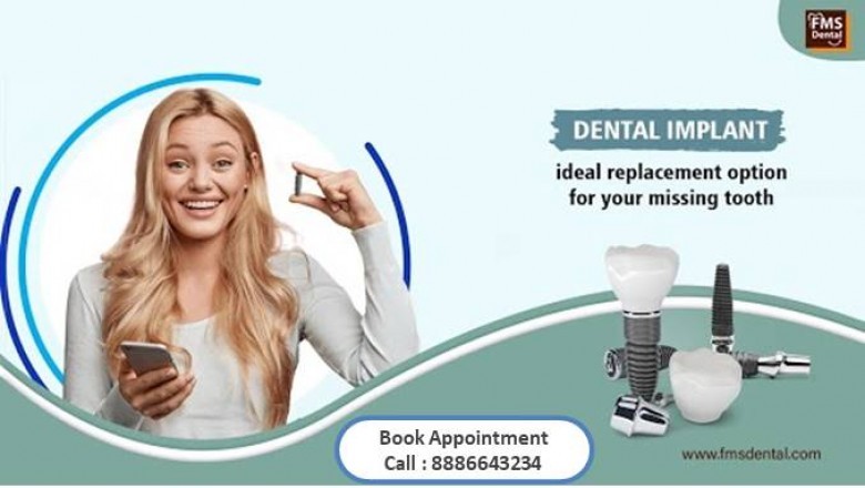 Best Dental Implant Clinic in India | Best Dental Implant Clinic in Hyderabad | Best Dental Implant Hospital in India