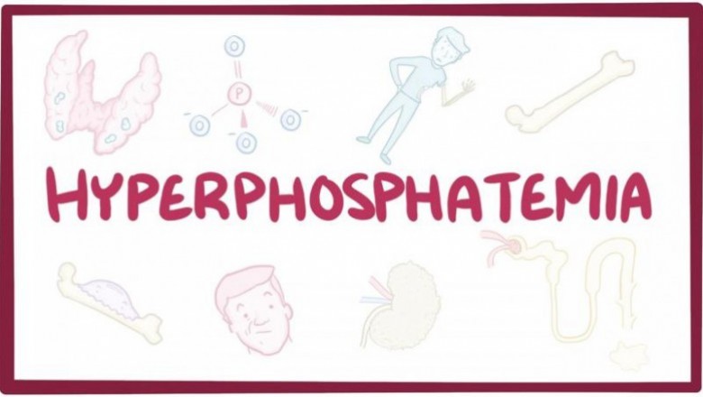 Hyperphosphatemia Drugs Market Size, Trends, Shares, Insights and Forecast – 2018-2026