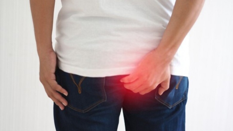 How To Get Rid of Hemorrhoids - Ways to getting rid of Hemorrhoids?