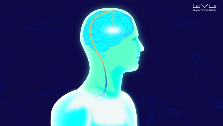 Brain Implants Market Size Worth $9.2 Billion By 2028