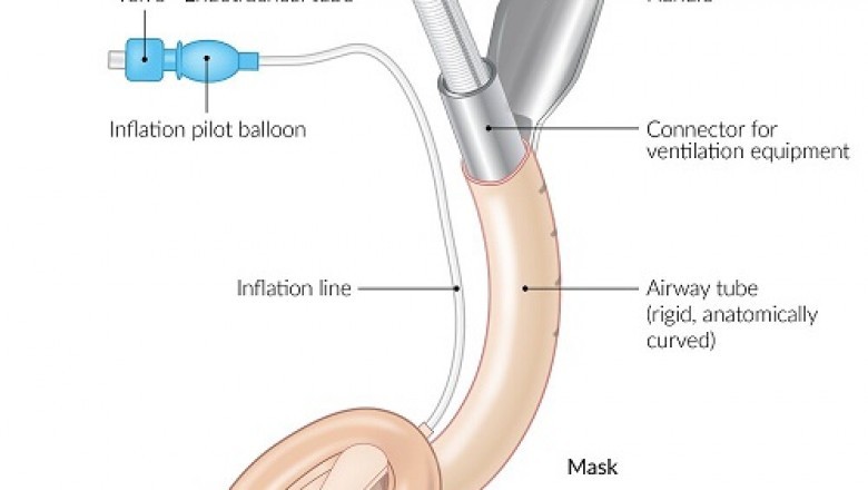 Future Scope of Airway Management Tubes Market | Estimated to Grow CAGR Rapidly | Foreseen till 2028