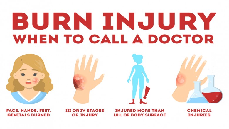How bad should a burn be for it to be hospitalized?