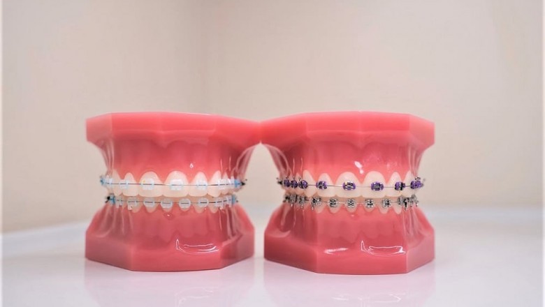 Professional Children Dentists Provide The Best Treatments!