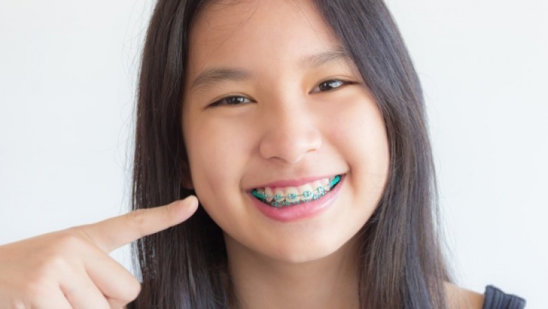 What Does Your Orthodontist Say About Kids Braces?