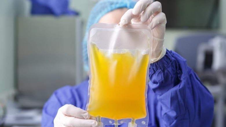 Global Plasma Therapy Treatment Market SWOT Analysis, Key Indicators and Forecast To 2028
