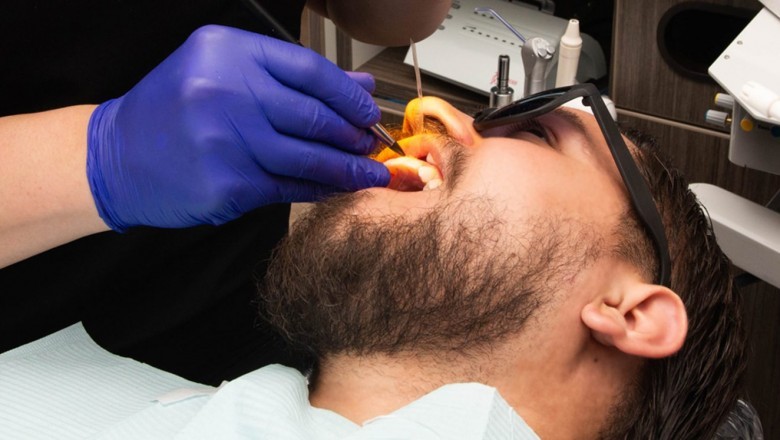 Why Dental Implants Are Better Than Other Procedures?