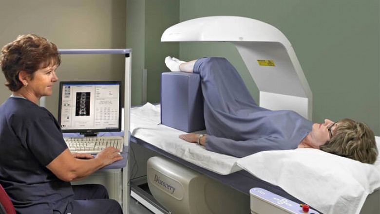 Analysis by technology helps to understand the various types of technologies used in Bone Densitometers.