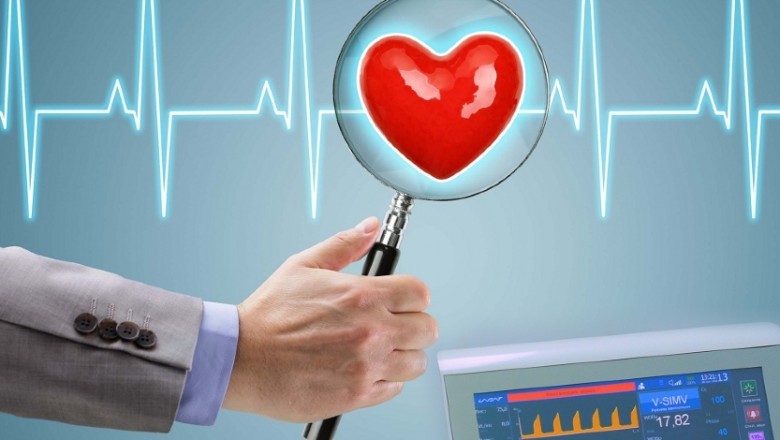 ECG Management System Market Report | Regional Analysis & Keyplayers