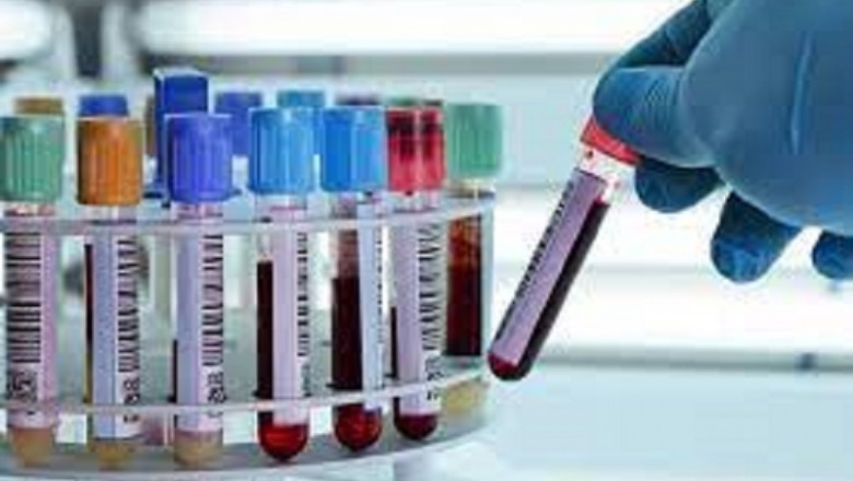 Heavy Metal Testing Market research by dbmr forecast to 2027