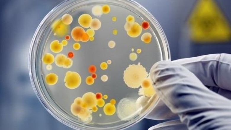 Global Microbiology Testing Market Growth, Trends, Competitive Analysis by Leading Players, Demand, Outlook by 2027