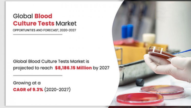 Blood Culture Test Market Growth, Trends and Value Chain 2020-2027