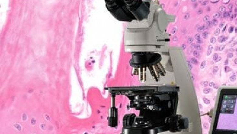 Clinical Upright Microscopes Market To Generate Massive Revenue in Upcoming Future by 2030