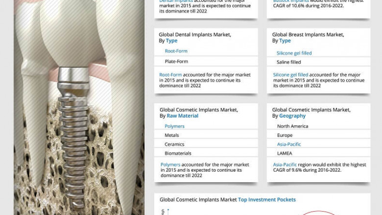 Cosmetic Implants Market Insights and Trends 2014, Forecast to 2022
