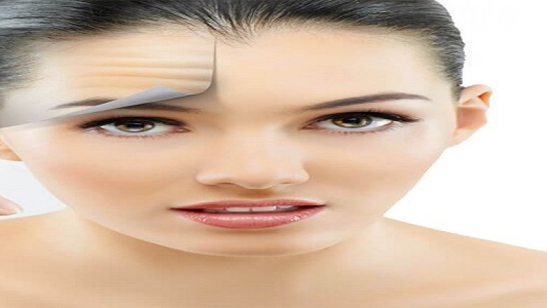 Best Botox in London
