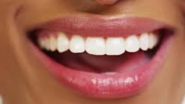 Dazzle Your Smile With Laser Whitening Method