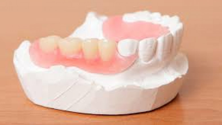 How Long Does it Take for Wisdom Teeth to Heal?