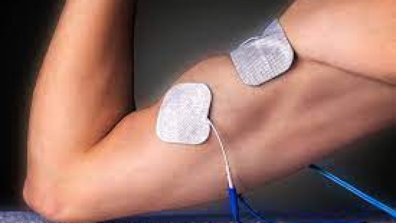 Electrical muscle stimulation Market (impact of COVID-19) Growth, Overview with Detailed Analysis 2020-2027| NeuroMetrix, Cogentix Medical, Cyberonics