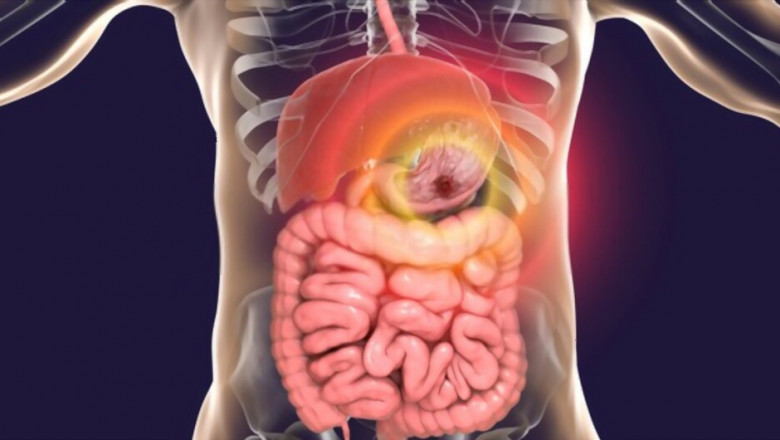 Medicine for Digestion Problem - Reasons to Choose Herbal Medicine for Digestion Problem
