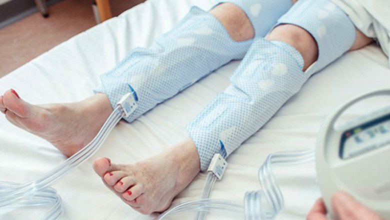 Compression Therapy Market Share, Size, Expected CAGR, Future Investment to 2027