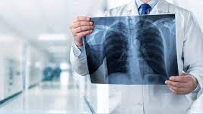 Radiology Services Market - Trends, Growth, including COVID19 Impact, Forecast By 2026