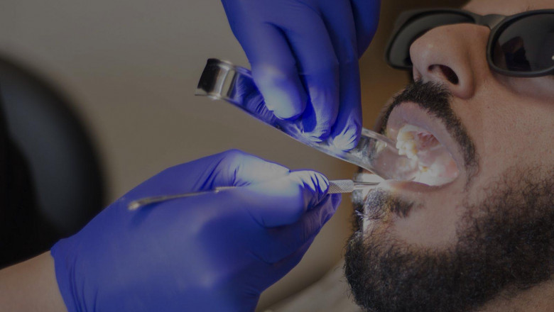 Dazzle-Your-Smile-With-Laser-Whitening-Method-dentisthoustontx