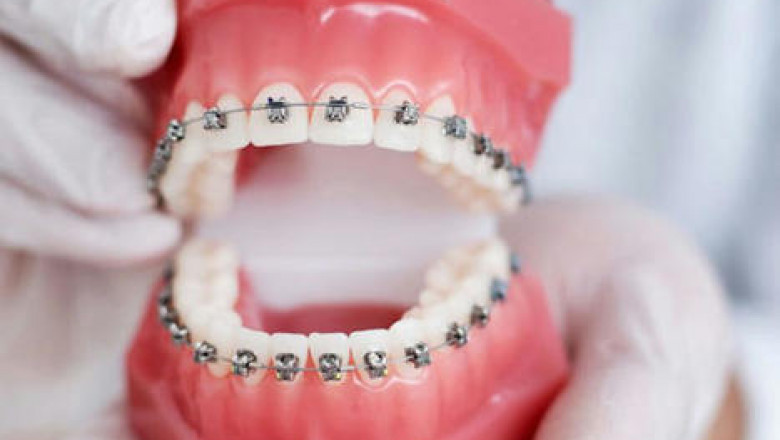 Top Orthodontists In Miami, Florida