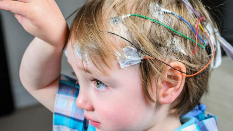 Brain Health Devices are used to detect brain waves, temperature, functionality, and structure by monitoring neuron activity