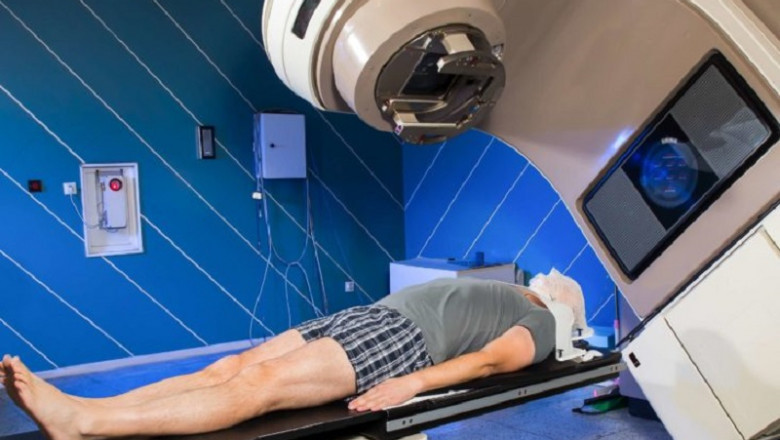 Radiotherapy Market Overview, Analysis forecast to 2027