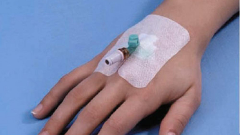 Rising incidences of infections such as central line associated bloodstream infection (CLABSI) and other infections are expected to boost growth of the I.V. dressing market