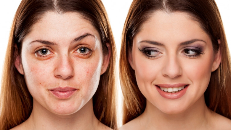 Dermal Fillers Market Dynamics, Comprehensive Analysis, Business Growth Prospects and Opportunities Up To 2027