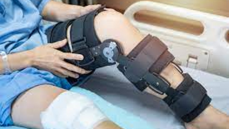 ACL Injuries: Partial or Complete Tears of Anterior Cruciate Ligament