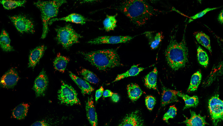 Live Cell Imaging Market Segments, Growth And Value Chain Analysis 2027 | Nikon Corporation (Japan), Olympus Corporation (Japan), Carl Zeiss AG (Germany
