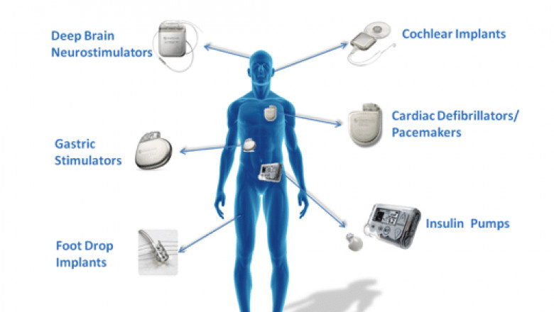 Medical Device Connectivity Market Overview, Key Enhancement, with Status, Trends and Future Prospective to 2027